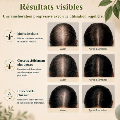 Savon Anti-Chute aux 12 Plantes Coréennes