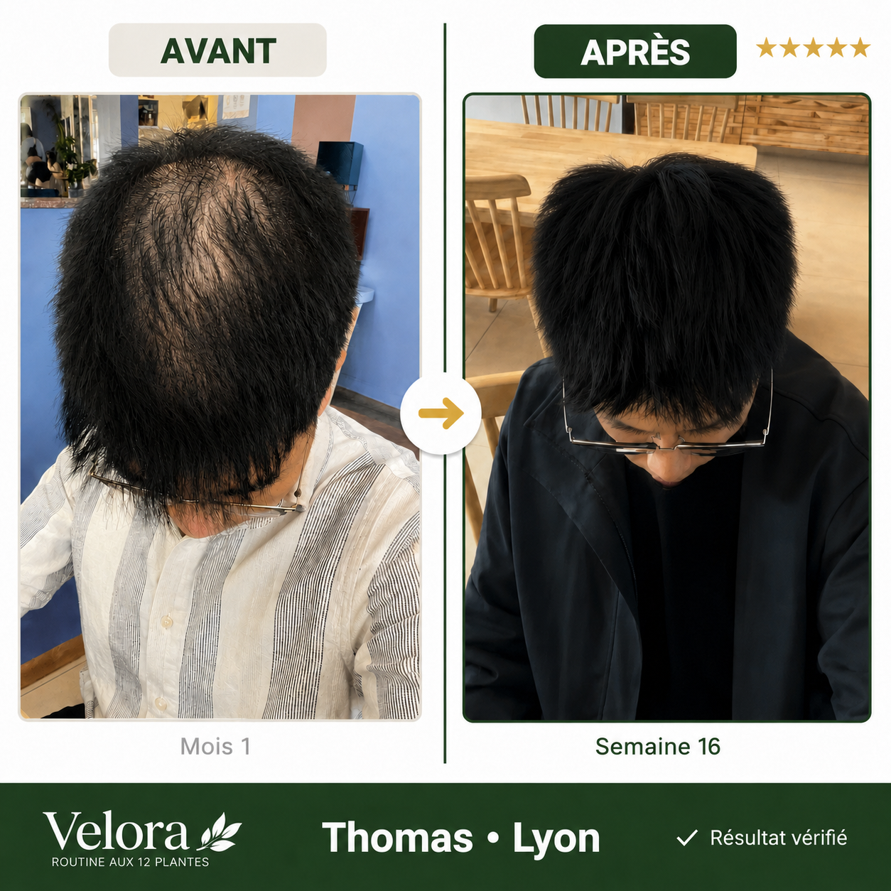 Savon Anti-Chute aux 12 Plantes Coréennes