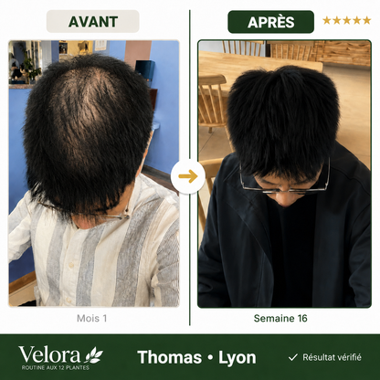 Savon Anti-Chute aux 12 Plantes Coréennes