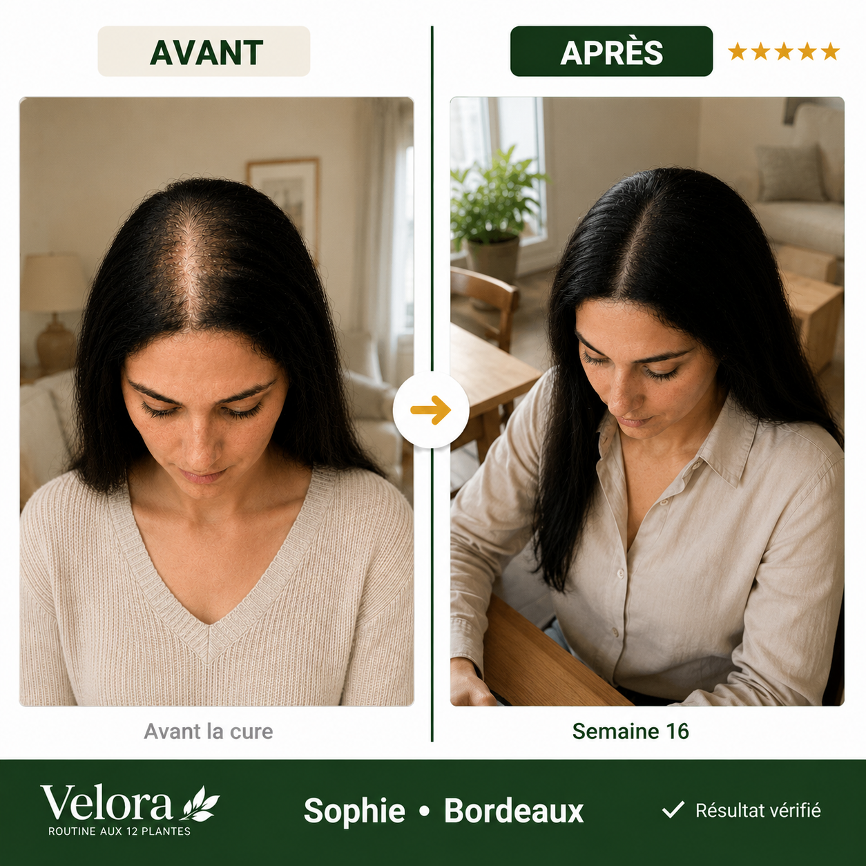 Savon Anti-Chute aux 12 Plantes Coréennes