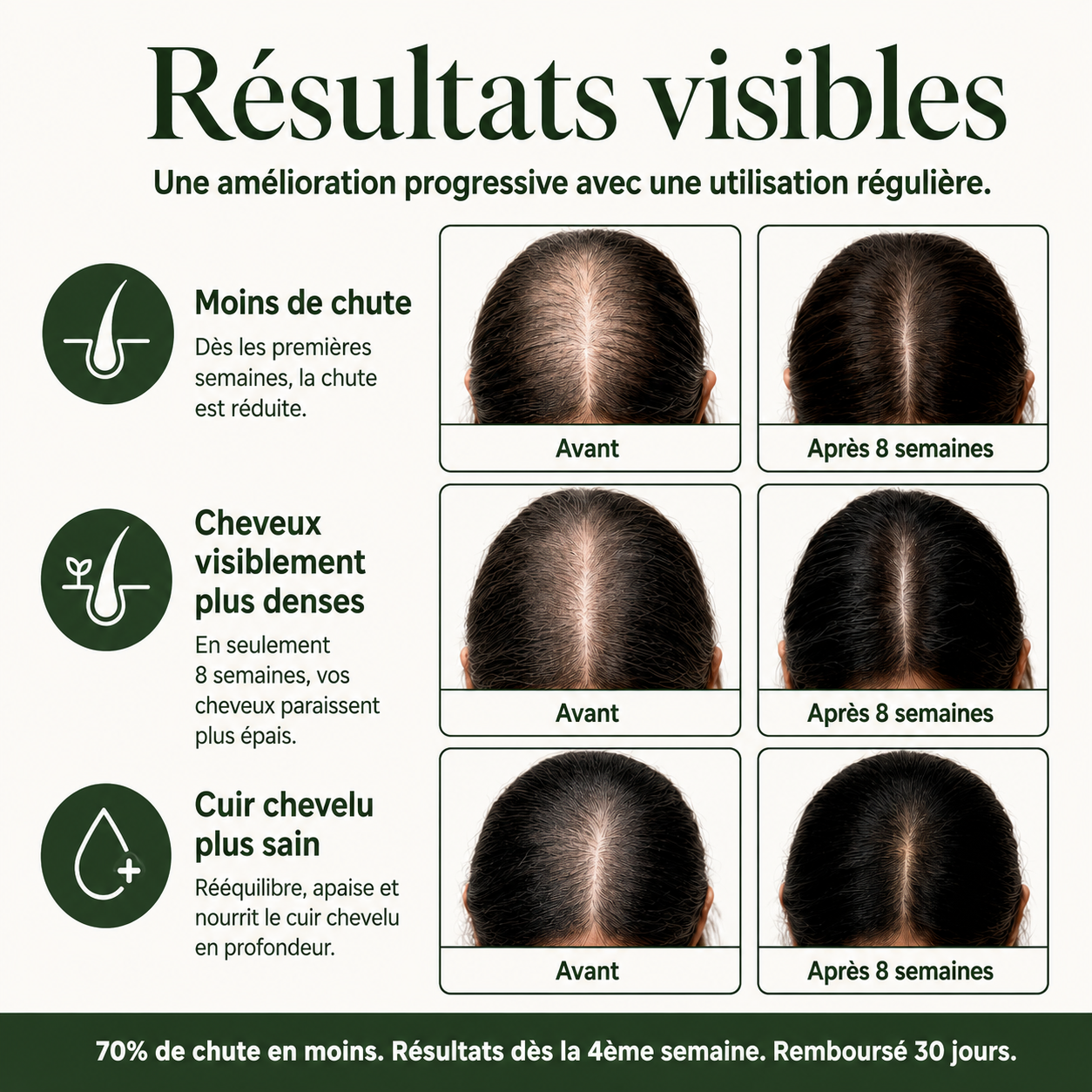 Savon Anti-Chute aux 12 Plantes Coréennes