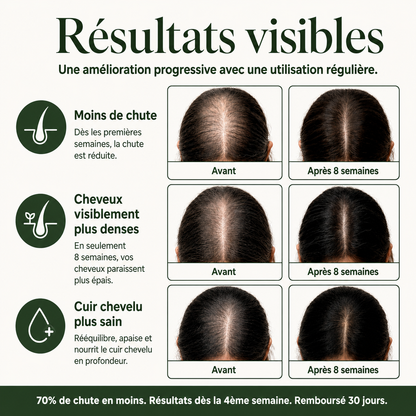 Savon Anti-Chute aux 12 Plantes Coréennes
